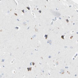 Invitrogen ECRG4 Polyclonal Antibody 100 &mu;L; Unconjugated:Antibodies,