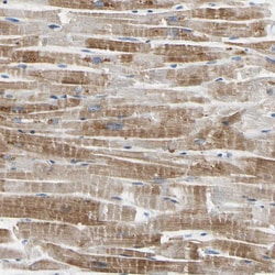 Invitrogen ECRG4 Polyclonal Antibody 100 &mu;L; Unconjugated:Antibodies,