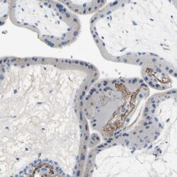 Invitrogen ECRG4 Polyclonal Antibody 100 &mu;L; Unconjugated:Antibodies,