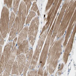Invitrogen ECRG4 Polyclonal Antibody 100 &mu;L; Unconjugated:Antibodies,