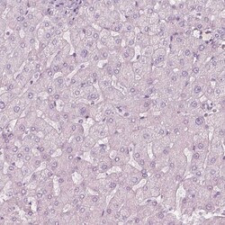 Invitrogen ZP4 Polyclonal Antibody 100 &mu;L; Unconjugated:Antibodies,