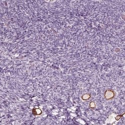 Invitrogen ZP4 Polyclonal Antibody 100 &mu;L; Unconjugated:Antibodies,