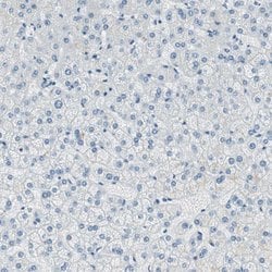 Invitrogen SLC22A2 Polyclonal Antibody 100 &mu;L; Unconjugated:Antibodies,