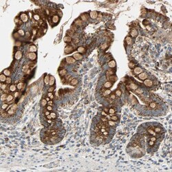 Invitrogen MRPL9 Polyclonal Antibody 100 &mu;L; Unconjugated:Antibodies,