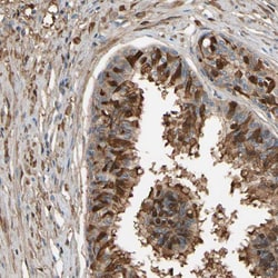 Invitrogen CSMD2 Polyclonal Antibody 100 &mu;L; Unconjugated:Antibodies