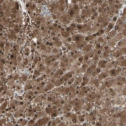 Invitrogen EVC Polyclonal Antibody 100 &mu;L; Unconjugated:Antibodies,