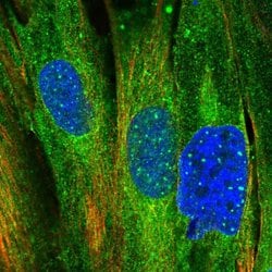 Invitrogen MRVI1 Polyclonal Antibody 100 &mu;L; Unconjugated:Antibodies,