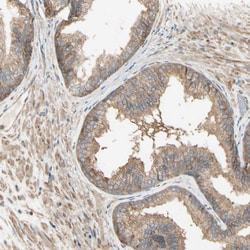 Invitrogen MRVI1 Polyclonal Antibody 100 &mu;L; Unconjugated:Antibodies,
