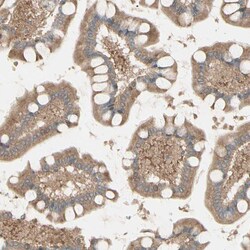 Invitrogen MRVI1 Polyclonal Antibody 100 &mu;L; Unconjugated:Antibodies,
