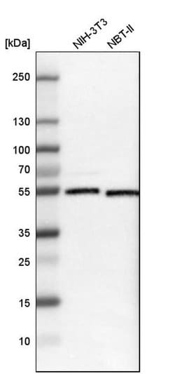 Invitrogen RNF14 Polyclonal Antibody 100 &mu;L | Buy Online | Invitrogen&trade; | Fisher Scientific