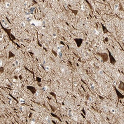 Invitrogen ANKHD1 Polyclonal Antibody 100 &mu;L; Unconjugated:Antibodies,