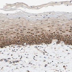 Invitrogen ANKHD1 Polyclonal Antibody 100 &mu;L; Unconjugated:Antibodies,