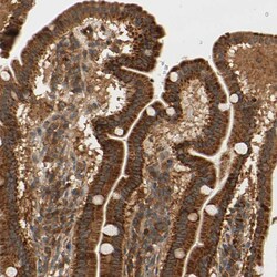 Invitrogen ANKHD1 Polyclonal Antibody 100 &mu;L; Unconjugated:Antibodies,