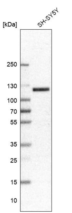 Invitrogen Chromogranin B Polyclonal Antibody 100 &mu;L; Unconjugated:Antikörper