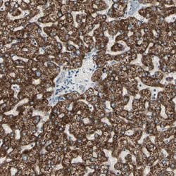 TMEM176A Polyclonal Antibody, Invitrogen 100 &mu;L | Buy Online | Invitrogen | Fisher Scientific