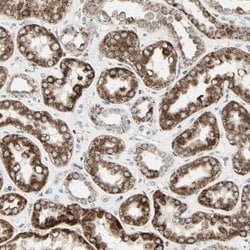 TMEM176A Polyclonal Antibody, Invitrogen 100 &mu;L | Buy Online | Invitrogen | Fisher Scientific