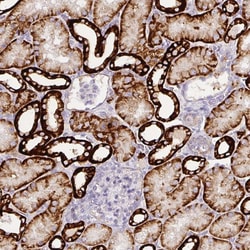 Invitrogen Carbonic Anhydrase XII Polyclonal Antibody 100 &mu;L; Unconjugated:Antibodies,