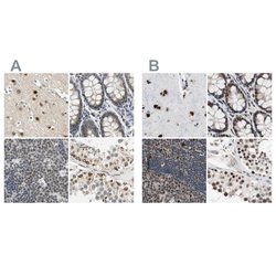 Invitrogen POGZ Polyclonal Antibody 100 &mu;L; Unconjugated:Antibodies,