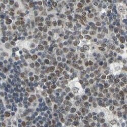 Invitrogen POGZ Polyclonal Antibody 100 &mu;L; Unconjugated:Antibodies,
