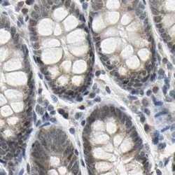 Invitrogen POGZ Polyclonal Antibody 100 &mu;L; Unconjugated:Antibodies,