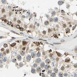 Invitrogen POGZ Polyclonal Antibody 100 &mu;L; Unconjugated:Antibodies,