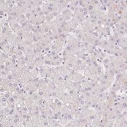 Invitrogen v-Myb Polyclonal Antibody 100 &mu;L; Unconjugated:Antibodies,