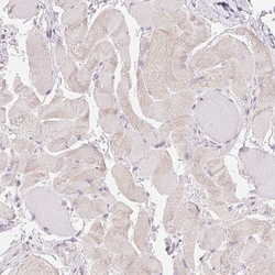 Invitrogen v-Myb Polyclonal Antibody 100 &mu;L; Unconjugated:Antibodies,