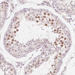 Invitrogen v-Myb Polyclonal Antibody 100 &mu;L; Unconjugated:Antibodies,