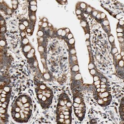 Invitrogen KIAA0907 Polyclonal Antibody 100 &mu;L; Unconjugated:Antibodies,
