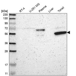 Invitrogen KIAA0907 Polyclonal Antibody 100 &mu;L; Unconjugated:Antibodies,