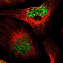 Invitrogen PDDC1 Polyclonal Antibody 100 &mu;L; Unconjugated:Antibodies,
