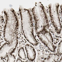 Invitrogen TSHZ3 Polyclonal Antibody 100 &mu;L | Buy Online | Invitrogen&trade; | Fisher Scientific
