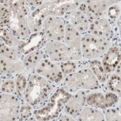 Invitrogen LONP2 Polyclonal Antibody 100 &mu;L | Buy Online | Invitrogen&trade; | Fisher Scientific