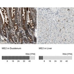 Invitrogen ME2 Polyclonal Antibody 100 &mu;L; Unconjugated:Antibodies,