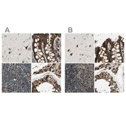 Invitrogen ME2 Polyclonal Antibody 100 &mu;L; Unconjugated:Antibodies,