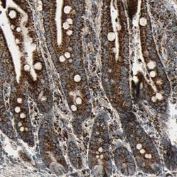 Invitrogen ME2 Polyclonal Antibody 100 &mu;L; Unconjugated:Antibodies,