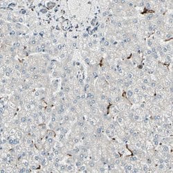 Invitrogen ME2 Polyclonal Antibody 100 &mu;L; Unconjugated:Antibodies,