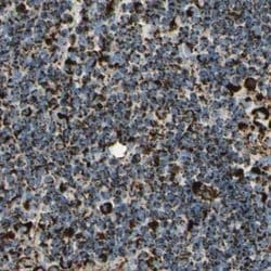Invitrogen ME2 Polyclonal Antibody 100 &mu;L; Unconjugated:Antibodies,