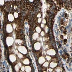 Invitrogen ME2 Polyclonal Antibody 100 &mu;L; Unconjugated:Antibodies,