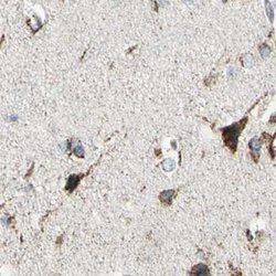 Invitrogen ME2 Polyclonal Antibody 100 &mu;L; Unconjugated:Antibodies,