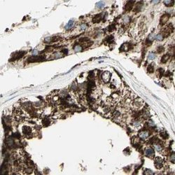 Invitrogen ME2 Polyclonal Antibody 100 &mu;L; Unconjugated:Antibodies,
