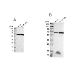 Invitrogen ME2 Polyclonal Antibody 100 &mu;L; Unconjugated:Antibodies,