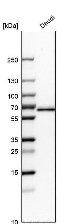 Invitrogen ME2 Polyclonal Antibody 100 &mu;L; Unconjugated:Antibodies,