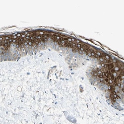 Invitrogen GPR125 Polyclonal Antibody 100 &mu;L; Unconjugated:Antibodies,