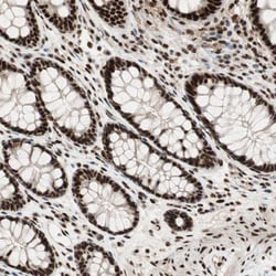 Invitrogen HEXIM1 Polyclonal Antibody 100 &mu;L; Unconjugated:Antibodies,
