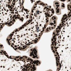 Invitrogen HEXIM1 Polyclonal Antibody 100 &mu;L; Unconjugated:Antibodies,