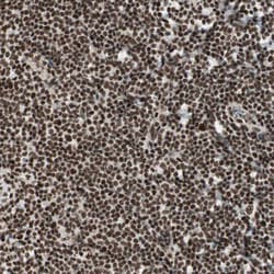 Invitrogen HEXIM1 Polyclonal Antibody 100 &mu;L; Unconjugated:Antibodies,