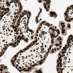 Invitrogen HEXIM1 Polyclonal Antibody 100 &mu;L; Unconjugated:Antibodies,