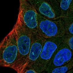 Invitrogen ENDOD1 Polyclonal Antibody 100 &mu;L; Unconjugated:Antibodies,