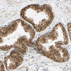 Invitrogen ENDOD1 Polyclonal Antibody 100 &mu;L; Unconjugated:Antibodies,
